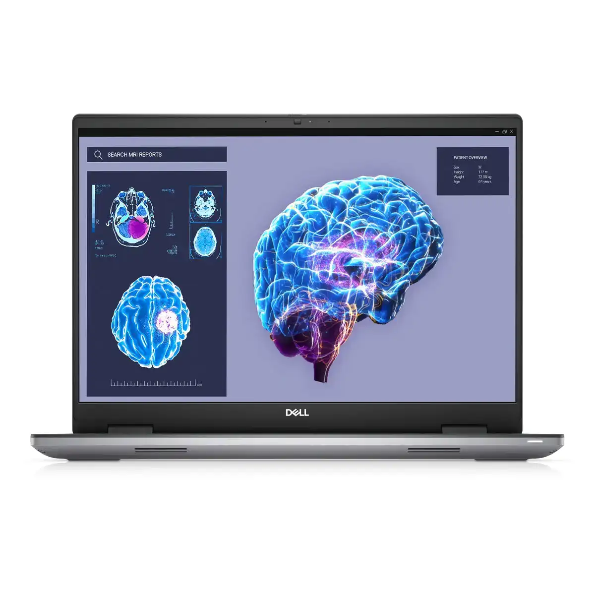 Ordinateur portable dell precision 7680 16 espagnol qwerty intel core i7 13850hx 1 tb ssd 32 gb ram_5508. Entrez dans l'Univers de DIAYTAR COTE D'IVOIRE - Où le Shopping Devient une Découverte. Explorez nos rayons et dénichez des trésors qui illuminent votre quotidien.