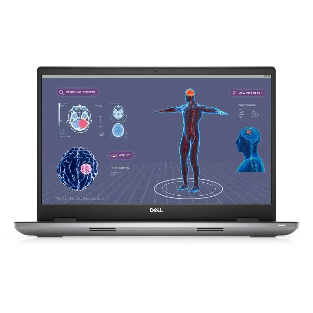 Ordinateur portable dell precision 7780 16 gb ram 512 gb ssd 17 3 espagnol qwerty intel core i7 13850hx_4257. Bienvenue sur DIAYTAR COTE D'IVOIRE - Votre Source de Trouvailles Uniques. Explorez nos rayons virtuels pour dénicher des trésors que vous ne trouverez nulle part ailleurs, allant des trésors artisanaux aux articles tendance.