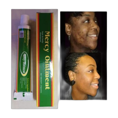 Crème concentré anti acné mercy