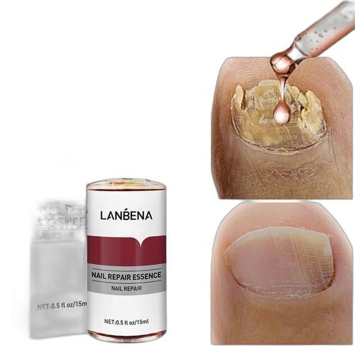 Lanbena traitement essence ongle pieds fongiques réparation soins