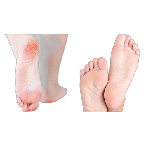 Outil de pédicure pour soins des pieds pour éliminer les callosités