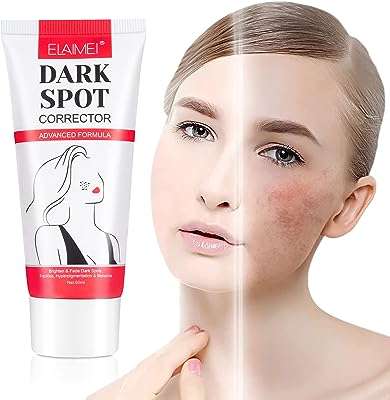 Crème correctrice de taches brunes sérum blanchissant anti âge pour le visage dissolvant rousseur et mélasma. Ne cherchez plus ailleurs, DIAYTAR COTE D'IVOIRE  est là pour vous offrir des produits à prix cassés. Parcourez notre boutique en ligne et découvrez notre large sélection de produits allant de la maison à l'électroménager, de l'informatique à la mode. Profitez de nos prix discount exceptionnels pour réaliser de grandes économies.
