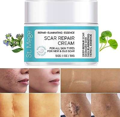 Crème anti cicatrices et vieilles cicatrices anti vergetures pour hommes et femmes soulagement des vergetures. Besoin de faire des économies sans sacrifier la qualité ? Ne cherchez pas plus loin que DIAYTAR COTE D'IVOIRE . Notre boutique en ligne généraliste propose des produits discount de premier choix pour la maison, l'électroménager, l'informatique et la mode. Offrez-vous le meilleur au meilleur prix avec DIAYTAR COTE D'IVOIRE .