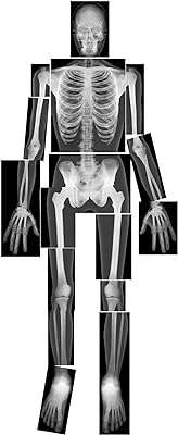 Roelco true2life x ray. Faites une affaire incroyable chez DIAYTAR COTE D'IVOIRE, votre destination en ligne pour des achats discount qui ne vident pas votre portefeuille ! Parcourez notre sélection complète de produits, des articles pour la maison aux gadgets dernier cri. Économisez sur les appareils informatiques de haute technologie et vos marques de mode préférées, tout en profitant d'une livraison rapide et d'un service client exceptionnel. Redéfinissez votre façon de magasiner avec nous et réalisez des économies substantielles dès maintenant !