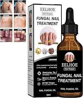 Traitement contre les champignons des ongles des pieds traitement pieds ou mains solution de réparation. DIAYTAR COTE D'IVOIRE  - votre guichet unique pour des achats discount en ligne. Parcourez notre catalogue diversifié et trouvez des produits de qualité à des prix incroyables. Avec notre large sélection allant de la maison à l'informatique en passant par l'électroménager, vous trouverez toujours ce dont vous avez besoin chez nous.