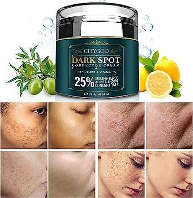 Dissolvant de taches brunes pour le visage et le corps crème. DIAYTAR COTE D'IVOIRE, votre destination shopping pour toutes les bonnes affaires. Découvrez notre large gamme de produits discount, des accessoires de mode aux articles pour animaux de compagnie. Faites des économies sur tous vos achats avec DIAYTAR COTE D'IVOIRE .