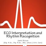 Interprétation ecg et reconnaissance du rythme