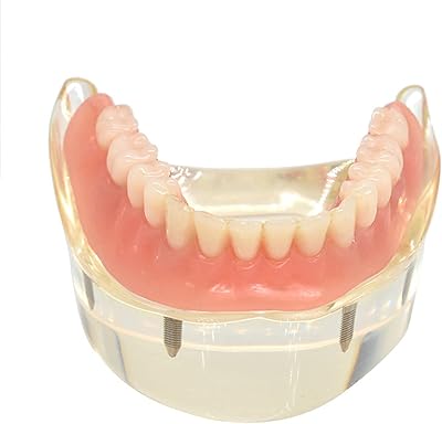 Modèle de restauration dentaire, modèle de dent de prothèse de pont buccal, modèle amovible de la mâchoire inférieure de la mâchoire inférieure, modèle de restauration d'implant à vis d'implant, enseignement avec 4 implants. En tant que boutique en ligne leader en Côte d'Ivoire, DIAYTAR COTE D'IVOIRE a gagné la confiance d'une large base de clients grâce à ses prix compétitifs, ses promotions régulières et son engagement à offrir les meilleurs produits disponibles sur le marché. La boutique continue d'innover et d'expander son offre pour répondre aux évolutions des besoins des consommateurs. Cela inclut une interface utilisateur conviviale et des modes de paiement sécurisés pour une expérience d'achat fluide.