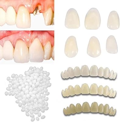 Kits de réparation dentaire temporaire wind bluegrass pour combler les dents cassées