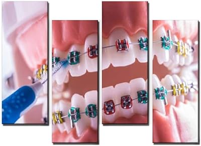 Modèle de dents orthodontiques wyokaton avec brosse à dents interne pour images d'art