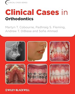 Cas cliniques en orthodontie. DIAYTAR COTE D'IVOIRE, la boutique en ligne numéro un en Côte d'Ivoire, se distingue par sa grande variété de produits et son engagement envers la satisfaction client. Avec des options de paiement flexibles et une politique de retour claire, vous pouvez acheter avec confiance sur DIAYTAR COTE D'IVOIRE. Que vous soyez un client fidèle ou nouveau sur la plateforme, vous bénéficierez d'une expérience d'achat personnalisée et d'un service exceptionnel.