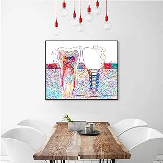 Photo d'art dentaire, impression sur toile, implant dentaire, dentiste, peinture murale, médecine, affiche
