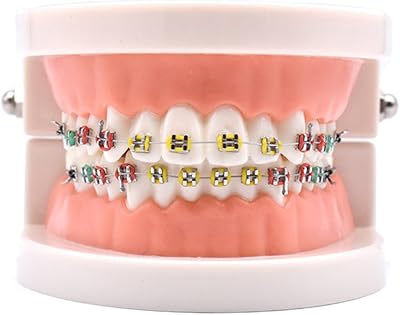 Modèle de dents orthodontiques avec support métallique et fil d'arc, ligatures de ligature du tube buccal. Avec plus de 300 000 références de produits, DIAYTAR COTE D'IVOIRE est la plus grande boutique en ligne de Côte d'Ivoire. Elle propose des produits de toutes les catégories, des électroniques aux produits alimentaires. La boutique est facile à utiliser et offre une expérience d'achat en ligne sécurisée.