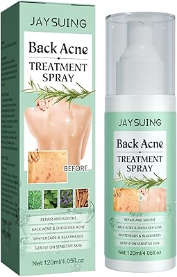 2023 nouveau spray de traitement de l'acné jaisingh 120 ml, spray de traitement