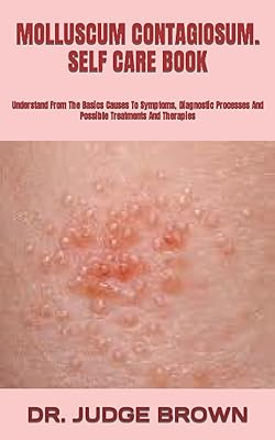 Molluscum contagiosum. livre de soins d'auto-soins : comprendre des causes de base aux