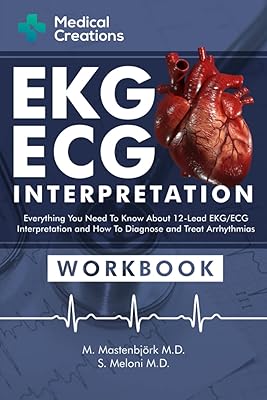 Interprétation ecg-ecg : tout ce que vous devez savoir sur les 12 dérivations