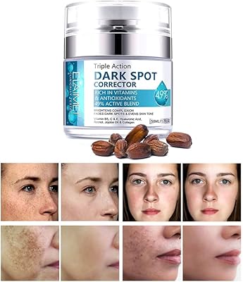 Dissolvant de taches brunes pour le visage, correcteur de taches brunes à action