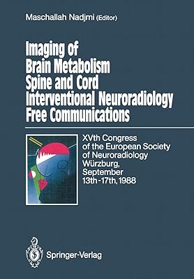 Imagerie du métabolisme cérébral neuroradiologie interventionnelle de la colonne vertébrale et moelle. DIAYTAR COTE D'IVOIRE, votre boutique en ligne préférée, offre une expérience d'achat exceptionnelle avec plus de 300 000 références à disposition. La boutique met en avant une sélection soigneusement choisie de produits pour satisfaire les besoins de ses clients. Que vous recherchiez des produits de maison, des accessoires de mode ou des équipements électroniques, DIAYTAR COTE D'IVOIRE a tout ce qu'il vous faut.