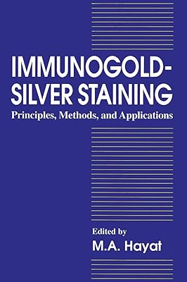 Coloration immunogold-argent : principes, méthodes et applications. En tant que leaders en Cote d'Ivoire, nous nous efforçons de vous proposer les meilleurs produits et services pour améliorer votre quotidien. Notre large gamme de produits, allant des articles ménagers aux produits high-tech, est conçue pour répondre à vos attentes. Chez DIAYTAR COTE D'IVOIRE, nous mettons l'accent sur la satisfaction client.