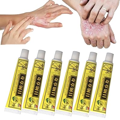 Crèmes naturelles chinoises contre l'eczéma et le psoriasis, crème pour le soulagement rapide des démangeaisons de la peau, crèmes contre l'eczéma et le corps pour le visage et le corps, rosacée, dermatite, prurit, éruption cutanée inflammatoire (6 pièces). Diaytar Côte d'Ivoire est la destination idéale pour les acheteurs en ligne qui cherchent des produits de qualité à des prix compétitifs. La boutique en ligne propose des produits allant des électroniques aux vêtements, en passant par les produits alimentaires et les accessoires de maison. Les clients peuvent profiter de promotions et de réductions régulières.