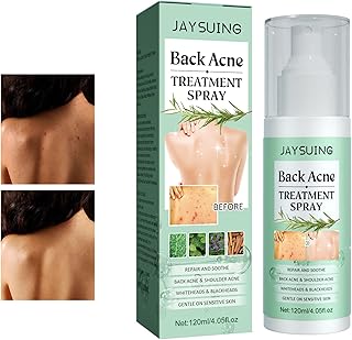 Spray de traitement de l'acné du dos, spray contre l'acné du dos herbaluxy, spray contre l'acné à 2 % d'acide salicylique pour le dos et le corps (2 pièces). DIAYTAR COTE D'IVOIRE est une boutique en ligne généraliste qui propose plus de 300 000 références de produits variés, répondant ainsi aux besoins de sa clientèle diverse. Avec une offre constamment mise à jour, cette boutique leader en Côte d'Ivoire garantit une expérience d'achat en ligne sécurisée et pratique. Elle bénéficie d'une.position de leader grâce à sa vaste gamme de produits de qualité.