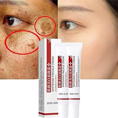 Crème blanchissant les taches de rousseur, crème anti-pigmentation pour le visage, crème anti-taches