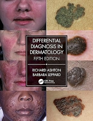 Diagnostic différentiel en dermatologie