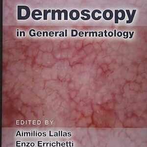 Dermoscopie en dermatologie générale