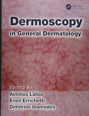 Dermoscopie en dermatologie générale